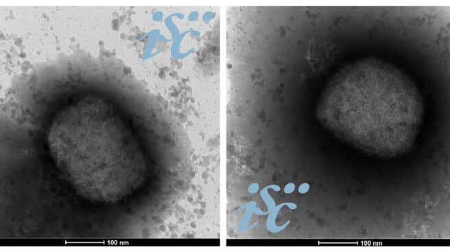 Dos imágenes, obtenidas por microscopía electrónica, del virus de la viruela del mono Dos imágenes, obtenidas por microscopía electrónica, del virus de la viruela del mono