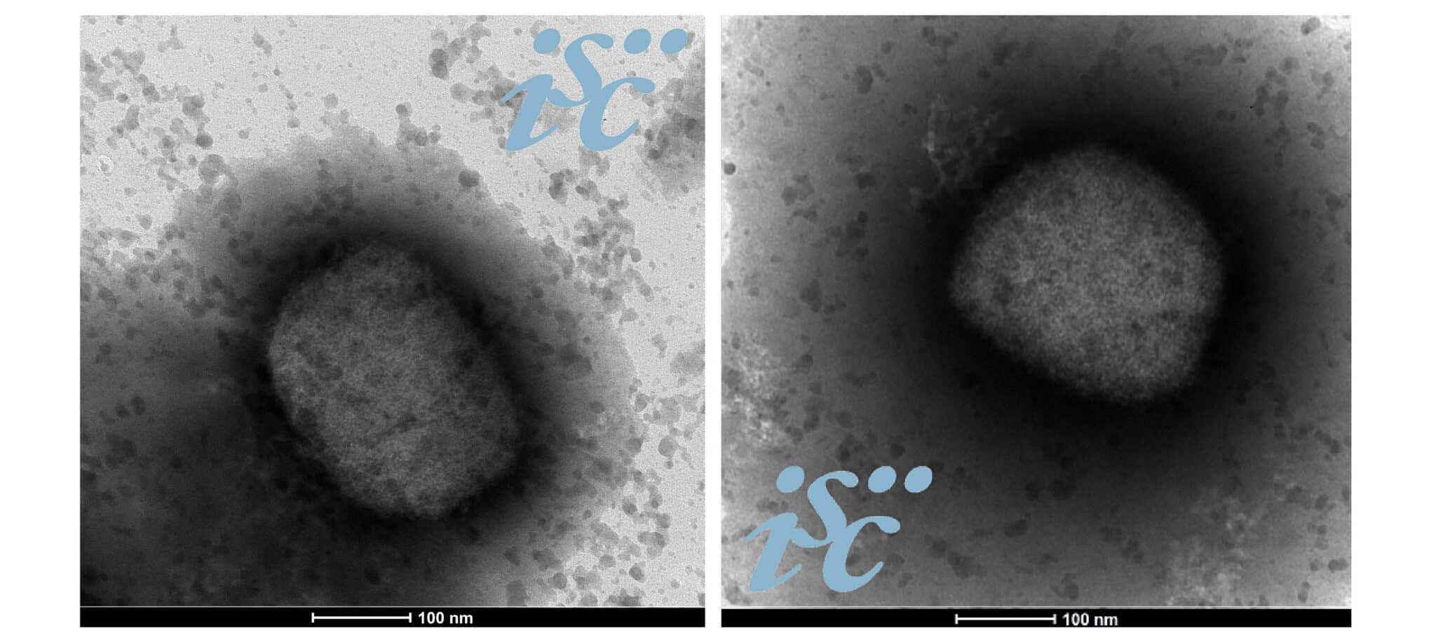Dos imágenes, obtenidas por microscopía electrónica, del virus de la viruela del mono