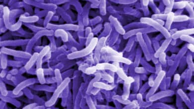 Cólera: síntomas, pronóstico y prevención para una enfermedad 'olvidada' en España