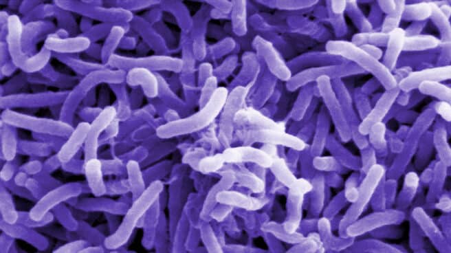 Vibrio cholerae: la bacteria que causa el cólera Vibrio cholerae: la bacteria que causa el cólera