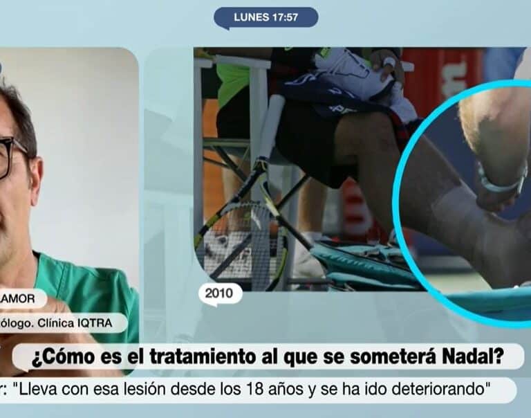 El doctor Ángel Villamor sobre la lesión de Nadal: "Es como si pisara una chincheta"