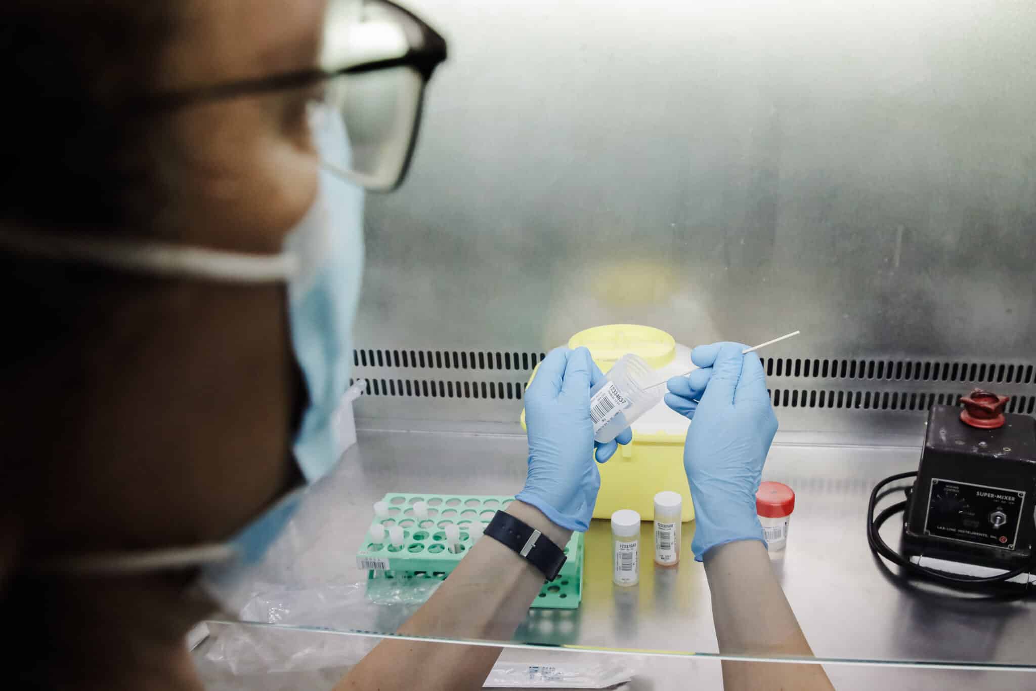 Una técnico de laboratorio sostiene una de las pruebas de análisis para la viruela del mono, en el Hospital Ramón y Cajal, en Madrid.