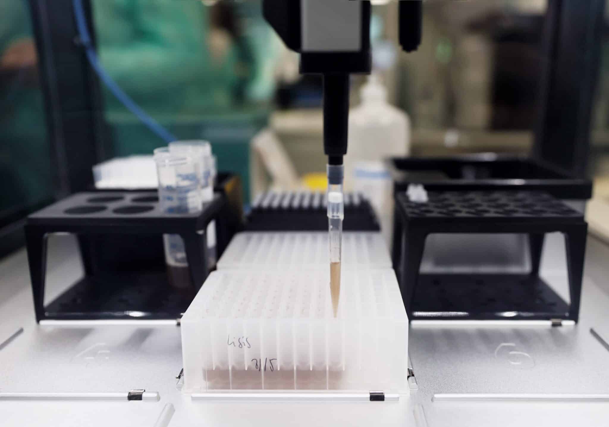 Probetas de pruebas PCR en el Laboratorio de Microbiología del Hospital público Gregorio Marañón