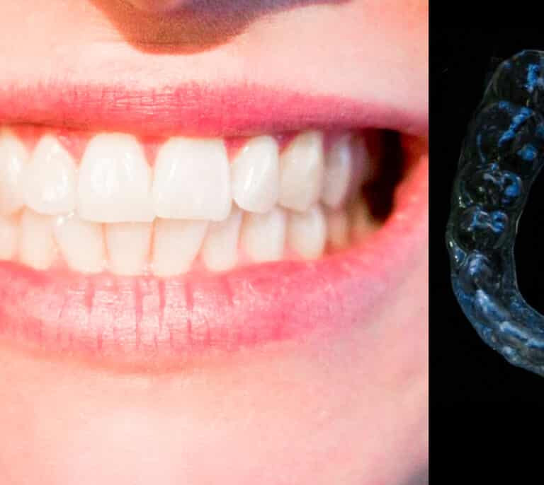 Los riesgos de la venta 'online' de ortodoncias, en auge desde hace años