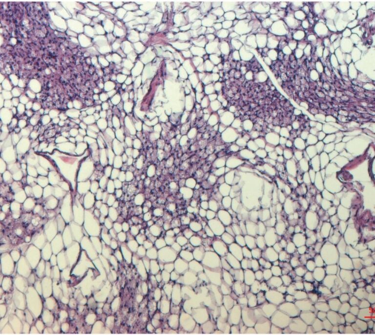 Purina inosina, la nueva molécula capaz de quemar grasa