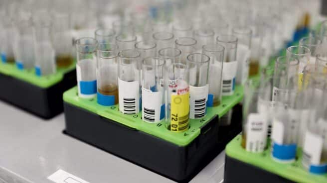 probetas-pcr-viruela-mono pruebas PCR para la viruela del mono