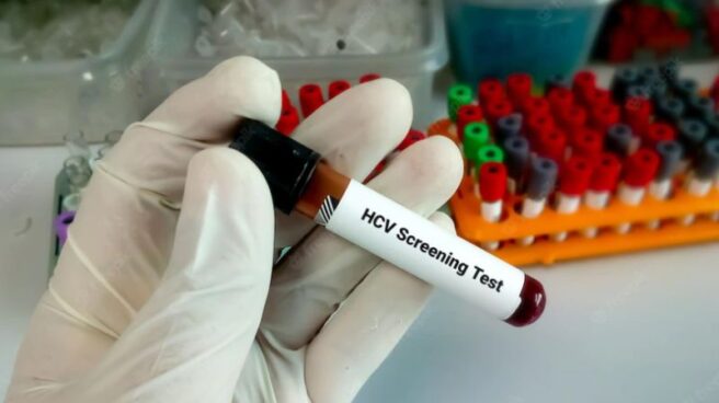 Test de hepatitis C