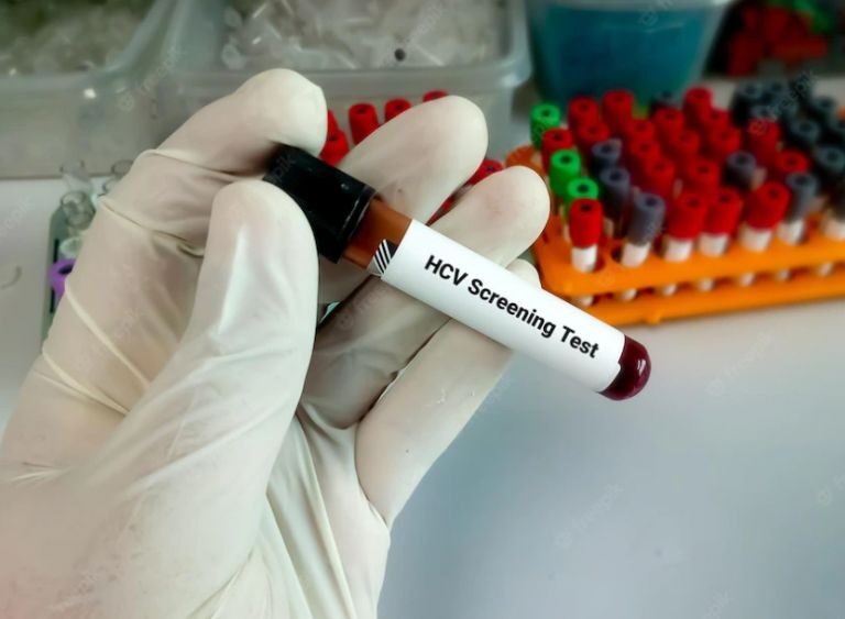 Expertos destacan las estrategias de cribado oportunista para facilitar el objetivo de eliminación de la hepatitis C en España