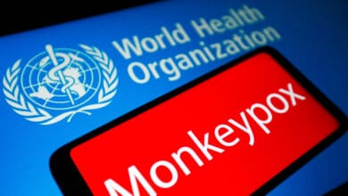España encabeza los casos de viruela del mono, emergencia internacional para la OMS