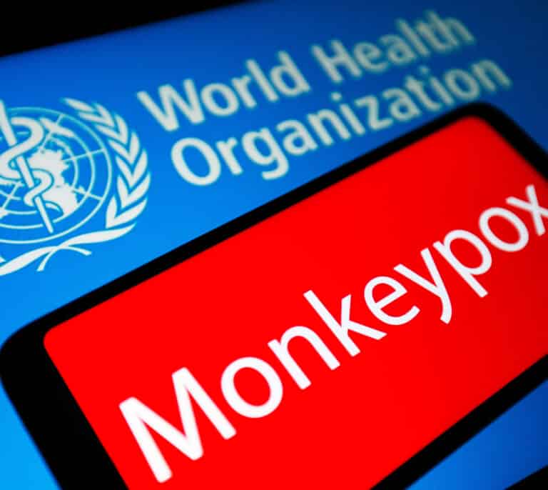 España encabeza los casos de viruela del mono, emergencia internacional para la OMS