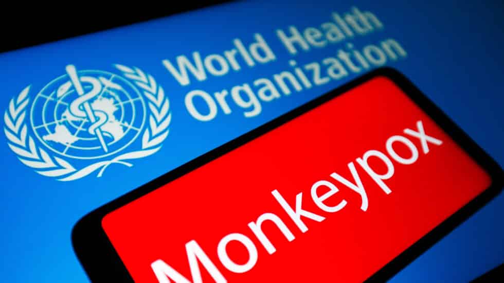 Dos meses del brote pandémico de viruela del mono