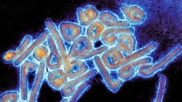 Así es la enfermedad del virus de Marburg, de la que Ghana ha decretado el primer brote