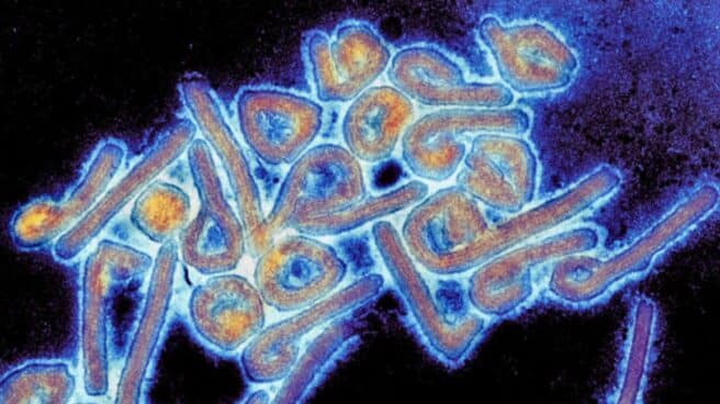 virus-marburg Imagen coloreada del virus de Marburg visto desde un microscopio.