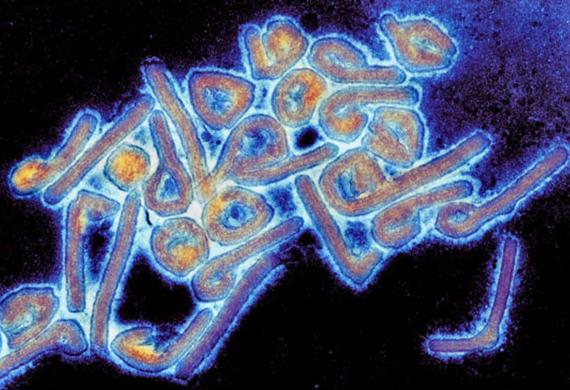 Imagen coloreada del virus de Marburg visto desde un microscopio.