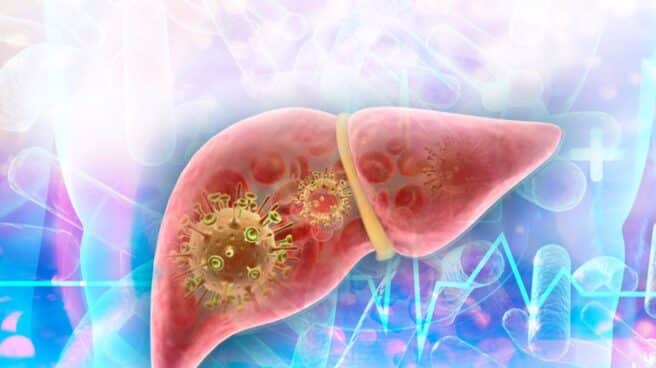 Sanidad notifica dos primeras muertes por hepatitis de origen desconocido: un niño de 6 años y un bebé de 15 meses Virus hepatitis, hígado