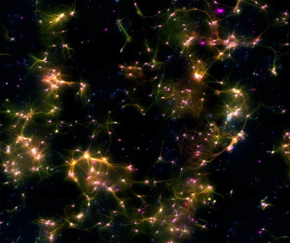 La ciencia atraviesa nuevas fronteras del gran enigma del cerebro