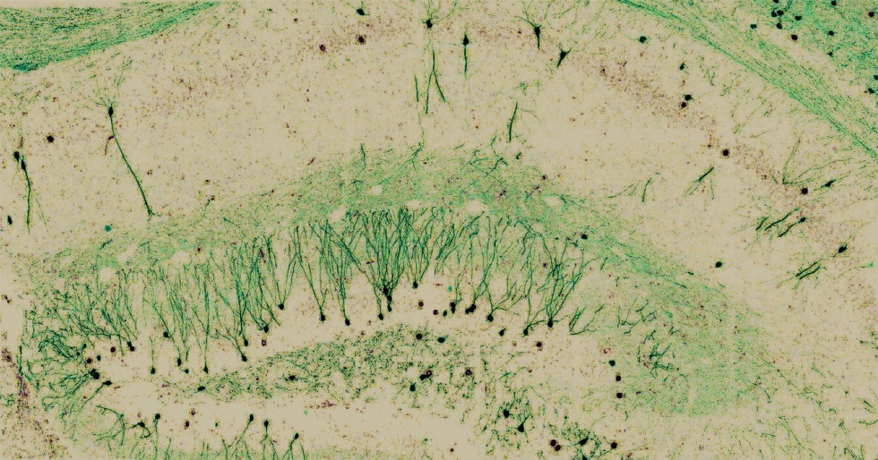 Recordando a Cajal /