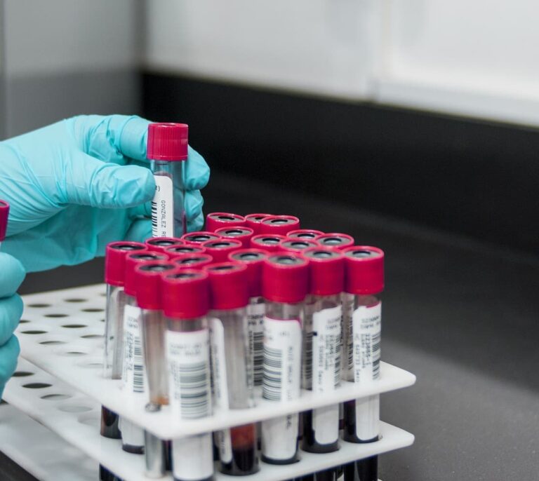 Investigadores descubren un método para predecir en 24 horas la supervivencia a la quimioterapia