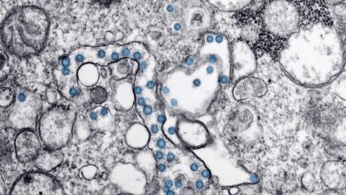 La clave para tratar el covid persistente está en las células zombies, según un estudio del CSIC