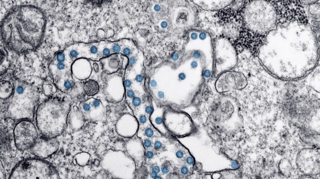 particulas_del_virus_sars-cov-2_coloreadas_en_azul_en_una_imagen_de_microscopio_de_electrones._cdc Partículas del virus SARS-CoV-2, coloreadas en azul, en una imagen de microscopio de electrones.