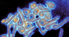 Alerta de la OMS por el virus de Marburgo: qué es, síntomas y cómo se contagia