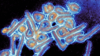 Alerta de la OMS por el virus de Marburgo: qué es, síntomas y cómo se contagia