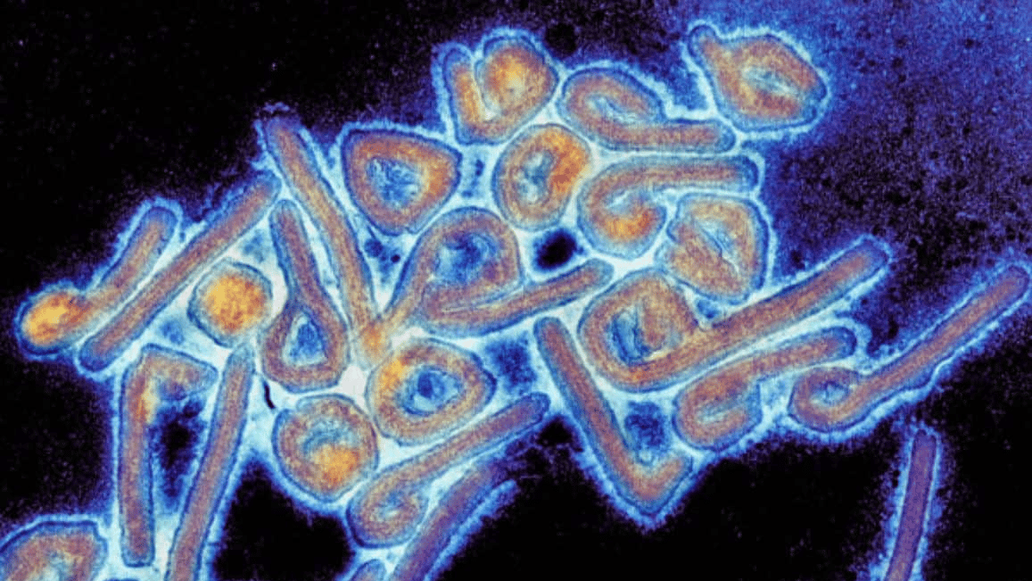 Virus de Marburgo que causa alerta sanitaria mundial por la OMS desde Guinea