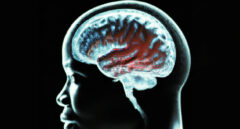 LAM561, el fármaco que podría alargar la corta vida de los pacientes con tumores cerebrales