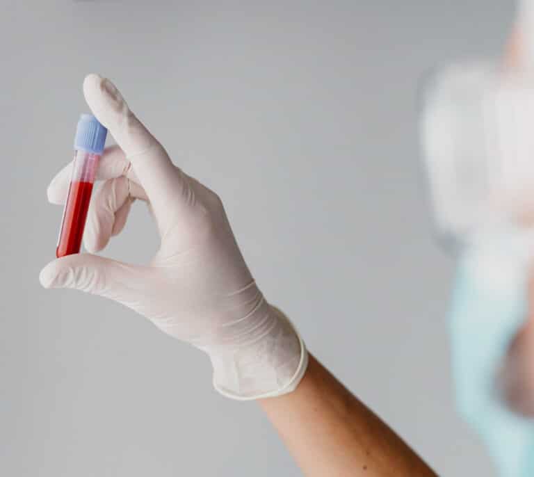 ¿Qué dice mi analítica de sangre? Estas son las claves para interpretarla