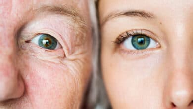 Ojo con el glaucoma: la primera causa de ceguera llega sin avisar