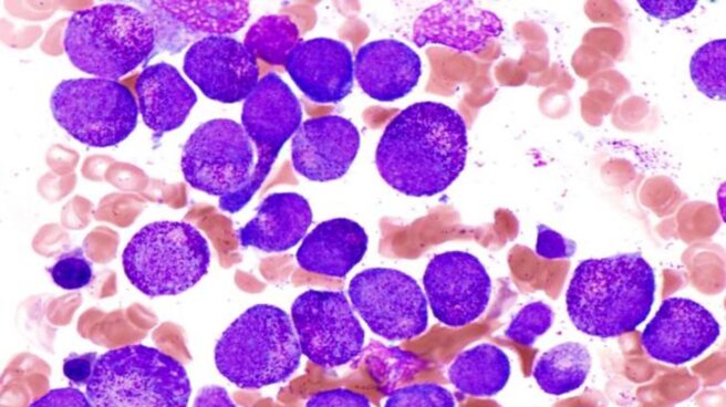 Un tratamiento de Gilead mejora la supervivencia en pacientes con linfoma B