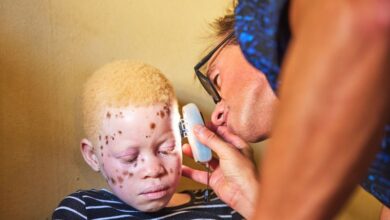 ISDIN ayuda a las personas con albinismo de Mozambique a luchar contra el cáncer de piel