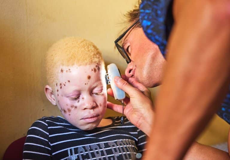 ISDIN ayuda a las personas con albinismo de Mozambique a luchar contra el cáncer de piel