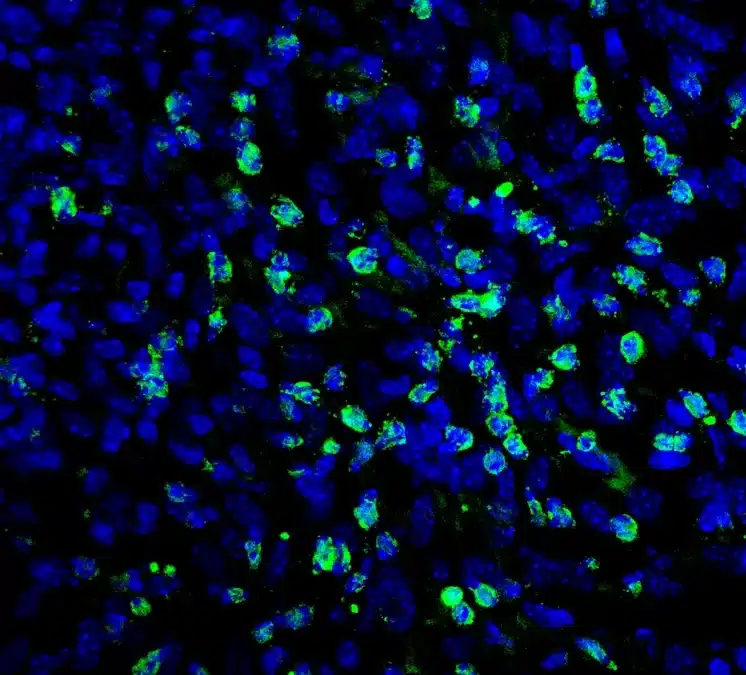 Células NK (en verde) actúan frente a células tumorales (en azul).
