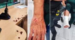 Así fue la brutal agresión a ocho guardias en Chiclana: brechas en la cabeza y articulaciones rotas