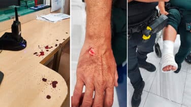 Así fue la brutal agresión a ocho guardias en Chiclana: brechas en la cabeza y articulaciones rotas