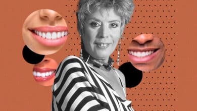 La obsesión por la dentadura perfecta, o por qué hoy María Jiménez no podría ser una estrella