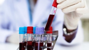 El fármaco Zanubrutinib para el tratamiento de leucemia linfocítica se usará en Reino Unido e Irlanda