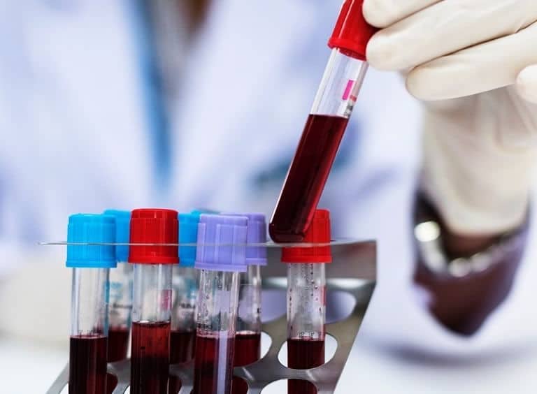 El fármaco Zanubrutinib para el tratamiento de leucemia linfocítica se usará en Reino Unido e Irlanda