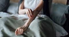 Las personas con urticaria crónica tardan más de tres años en conseguir un diagnóstico