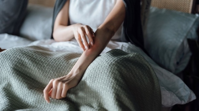 Las personas con urticaria crónica tardan más de tres años en conseguir un diagnóstico Persona con urticaria crónica