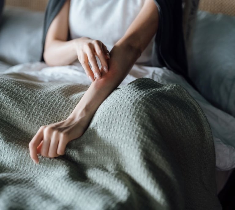 Las personas con urticaria crónica tardan más de tres años en conseguir un diagnóstico