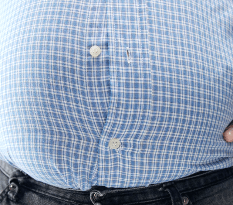 La obesidad y los kilos de más también impactan en tus huesos