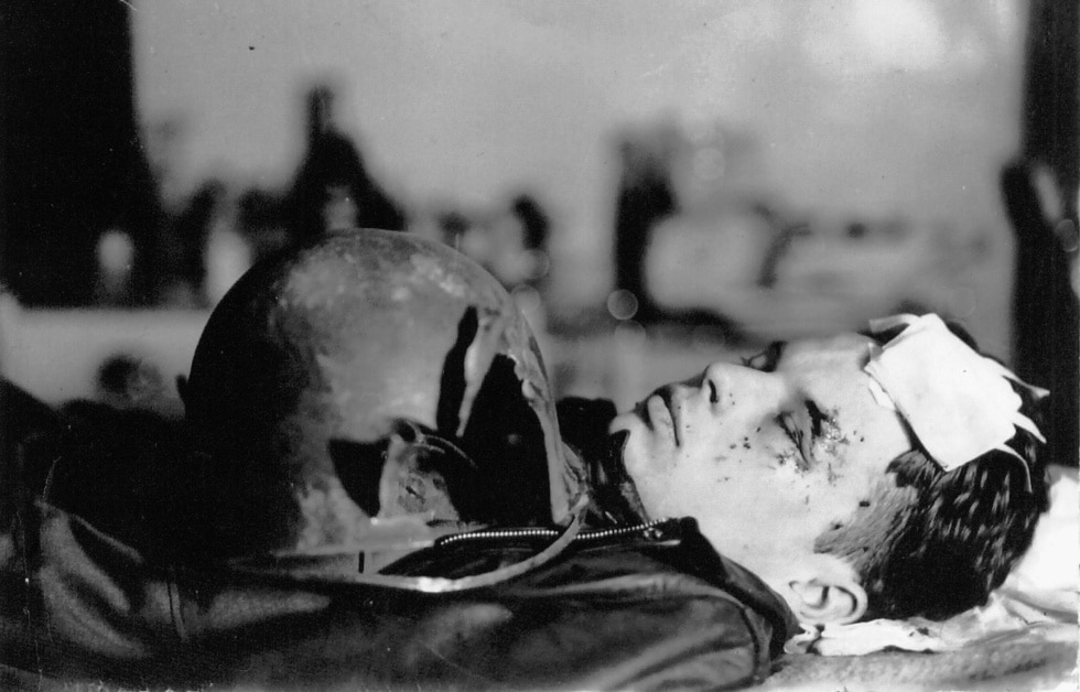 Herido por un proyectil de 20 mm disparado por un caza alemán frente al que de nada servía el casco.