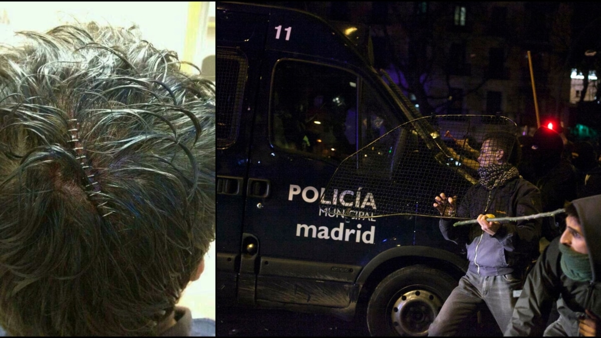 A la izquierda, imagen de la herida del jefe de la UIP por la agresión de los manifestantes. A la derecha, un momento de las Marchas de la Dignidad.