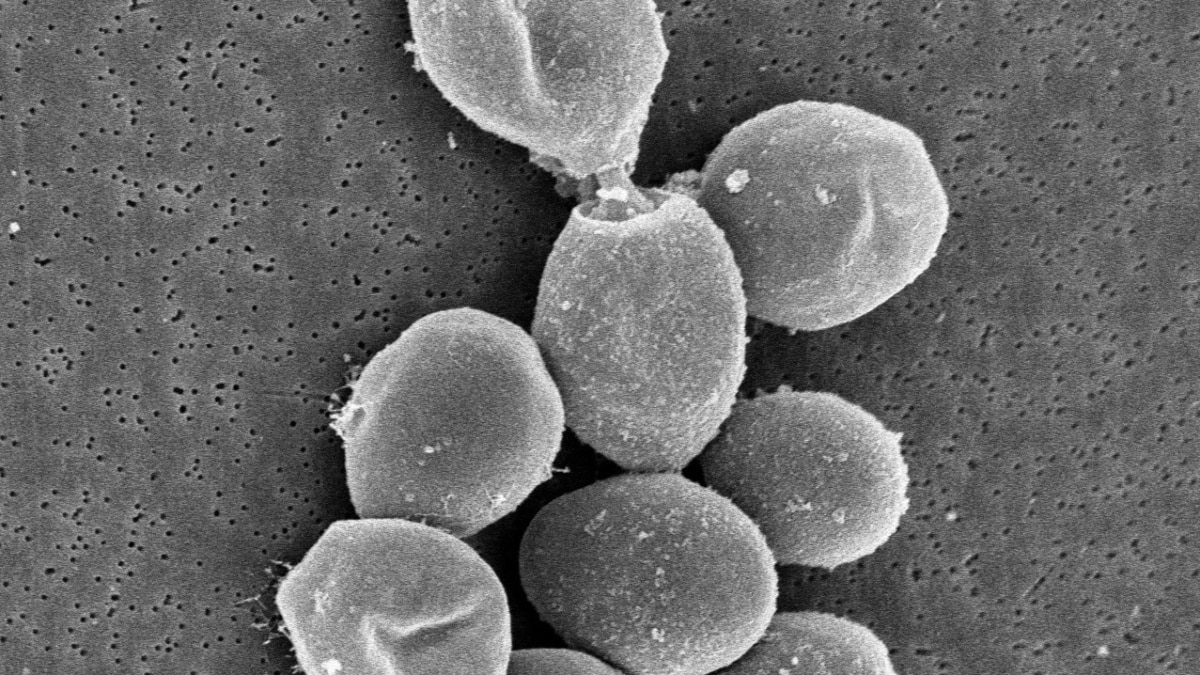 El CSIC patenta un método para producir serotonina, la "hormona de la felicidad", a partir de levadura de vino