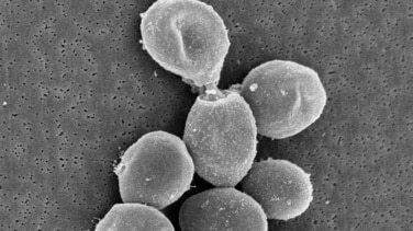 El CSIC patenta un método para producir serotonina, la "hormona de la felicidad", a partir de levadura de vino