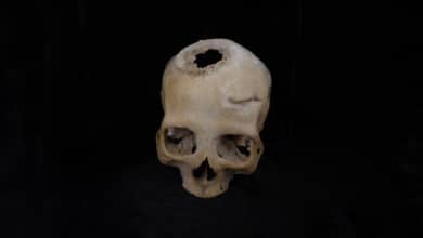 El extraño cráneo que ha destapado la primera cirugía de cáncer de la historia en el Antiguo Egipto
