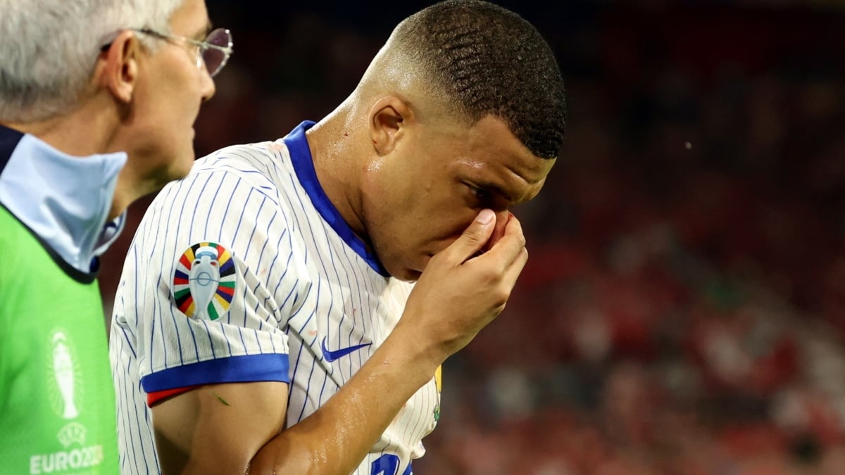 Kylian Mbappé se echa la mano al tabique nasal tras el golpe sufrido frente a Austria