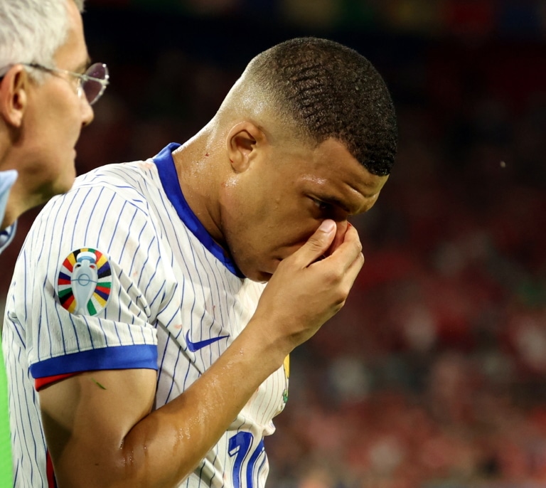 Mbappé regatea la operación tras romperse la nariz